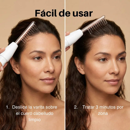 CapilRoot Pro - Recupera tu cabello y tu confianza en casa, sin químicos ni pastillas